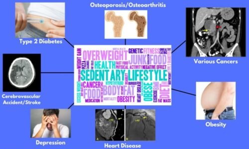 Impact of Sedentary Lifestyles. Lifestyles. Super Soldier Project.
