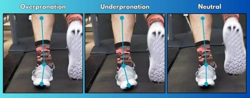 Illustration of three running foot gaits: overpronation with inward roll, underpronation with outward roll, and a neutral foot landing pattern.